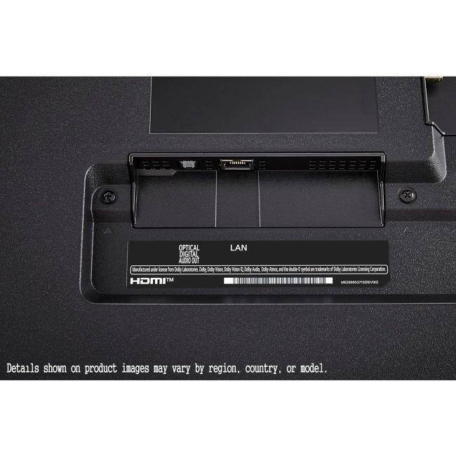 LG | 65